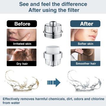 High Output Shower Filter for Hard Water, Removes Chlorine and Fluoride, Universal Multi-Stage Shower Water Softener Reduces Dry Itchy Skin, Scalp and Eczema, Chrome